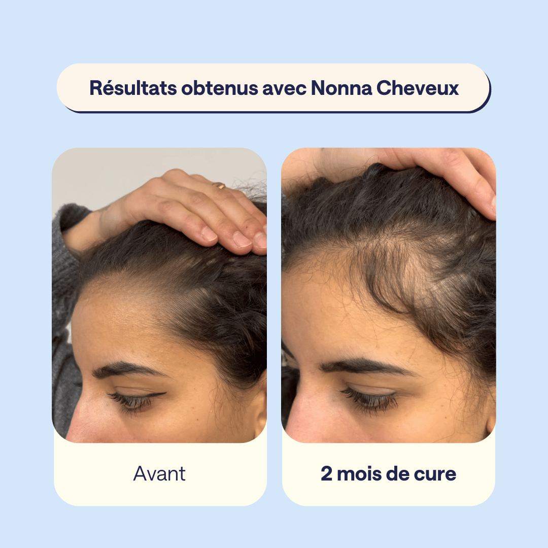 Nonna Cheveux - Redonnez force et vitalité à vos cheveux