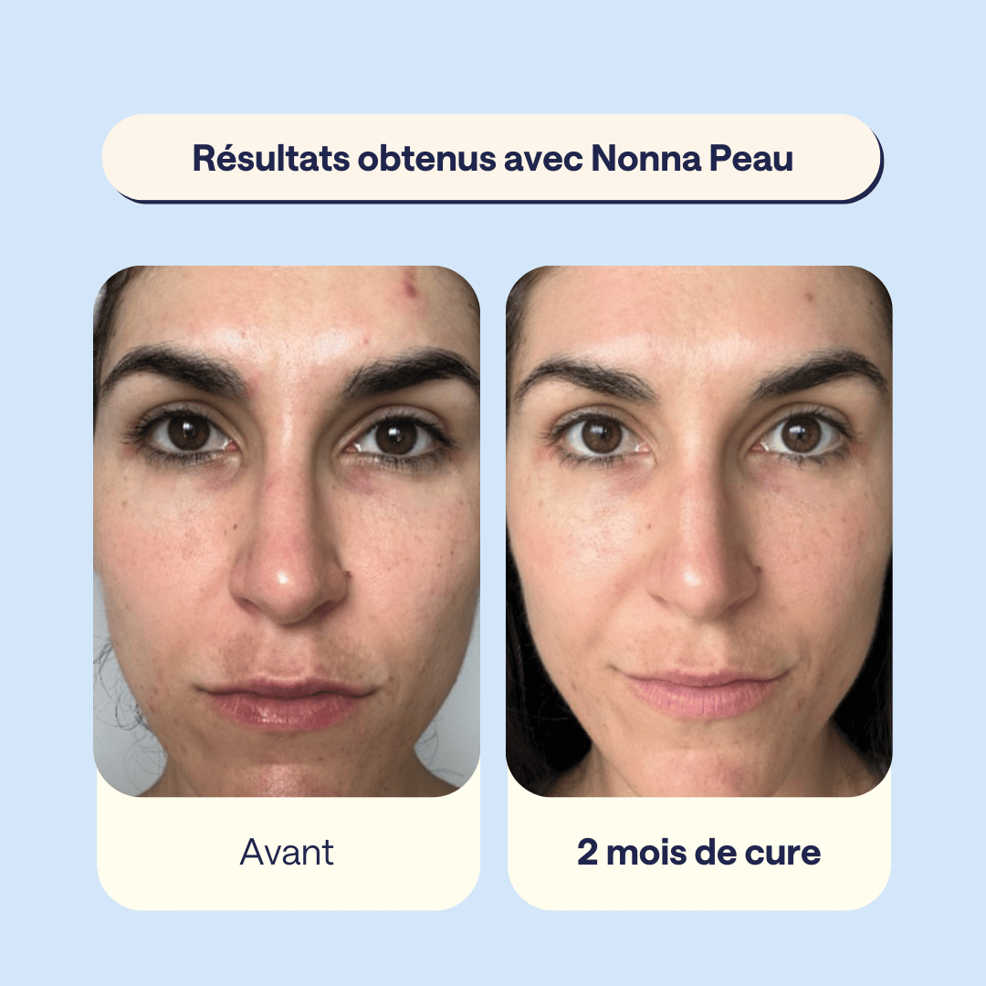 Nonna Peau - Sublimez votre peau de l'intérieur